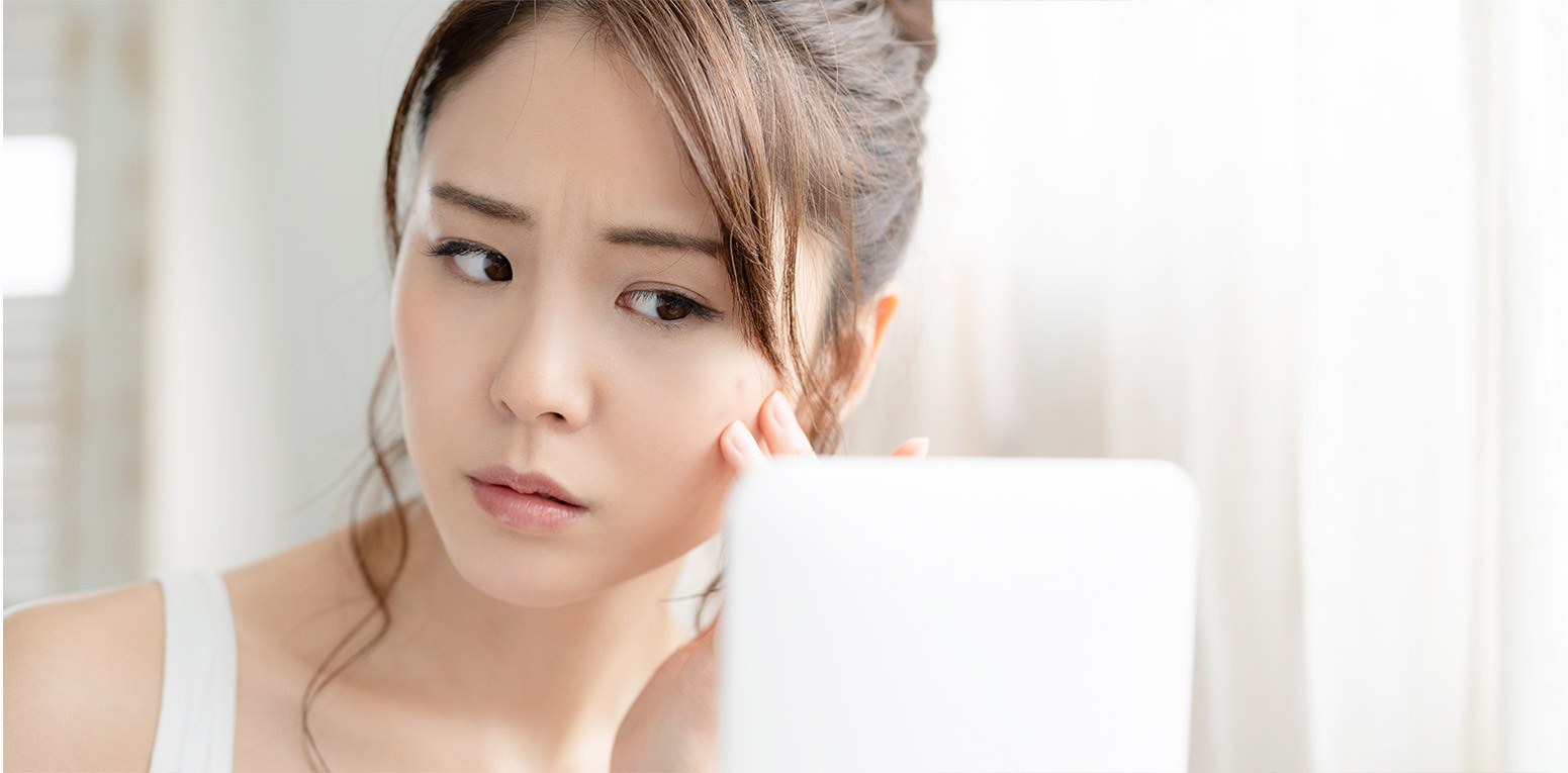 環境の変化で注意が必要な春の肌状態